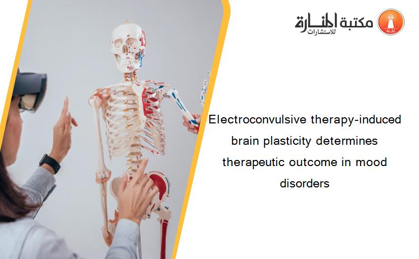 Electroconvulsive therapy-induced brain plasticity determines therapeutic outcome in mood disorders