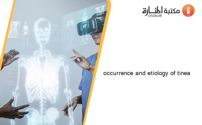 occurrence and etiology of tinea