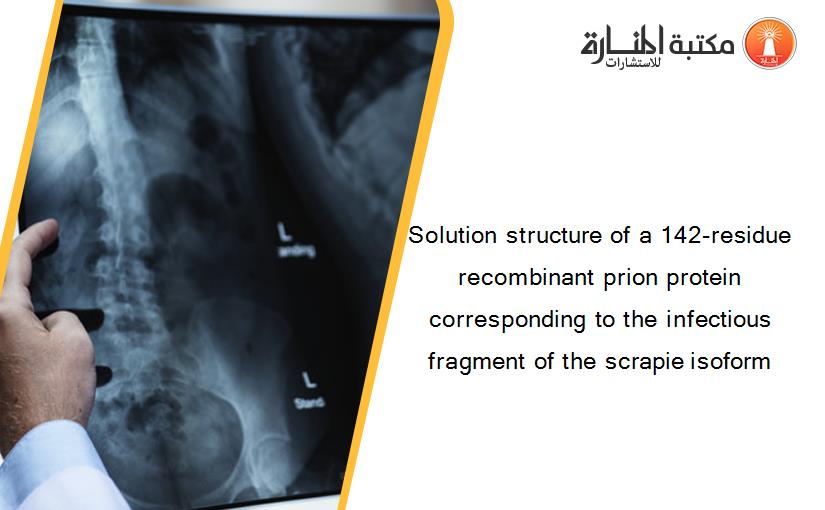 Solution structure of a 142-residue recombinant prion protein corresponding to the infectious fragment of the scrapie isoform