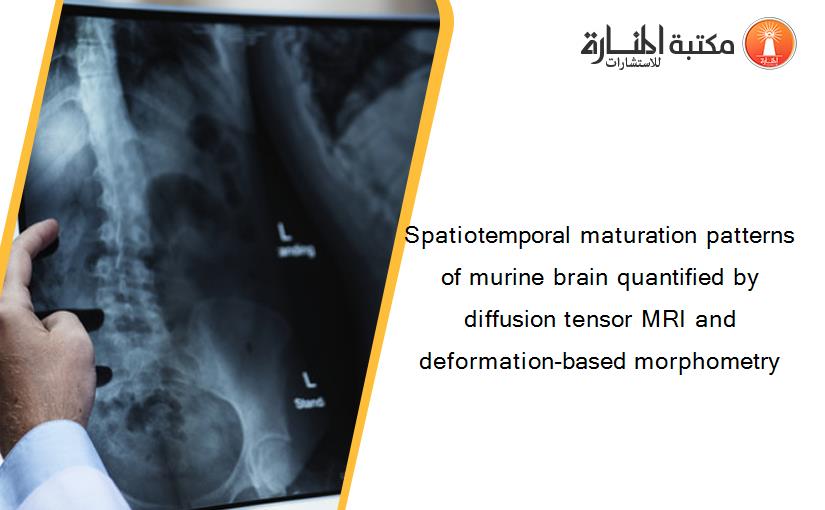 Spatiotemporal maturation patterns of murine brain quantified by diffusion tensor MRI and deformation-based morphometry