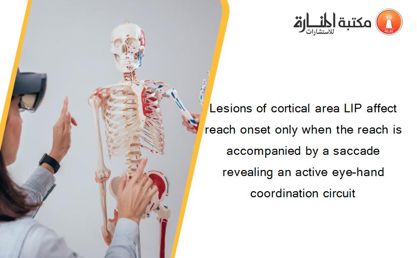 Lesions of cortical area LIP affect reach onset only when the reach is accompanied by a saccade revealing an active eye–hand coordination circuit