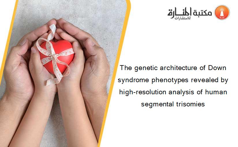 The genetic architecture of Down syndrome phenotypes revealed by high-resolution analysis of human segmental trisomies