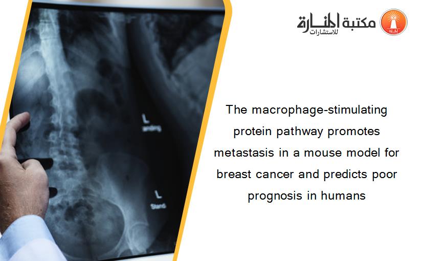 The macrophage-stimulating protein pathway promotes metastasis in a mouse model for breast cancer and predicts poor prognosis in humans