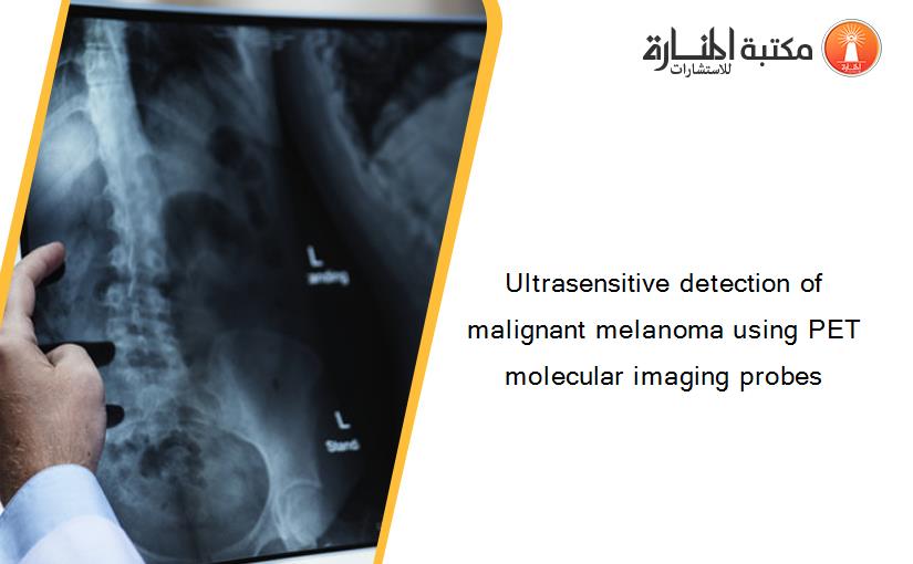Ultrasensitive detection of malignant melanoma using PET molecular imaging probes