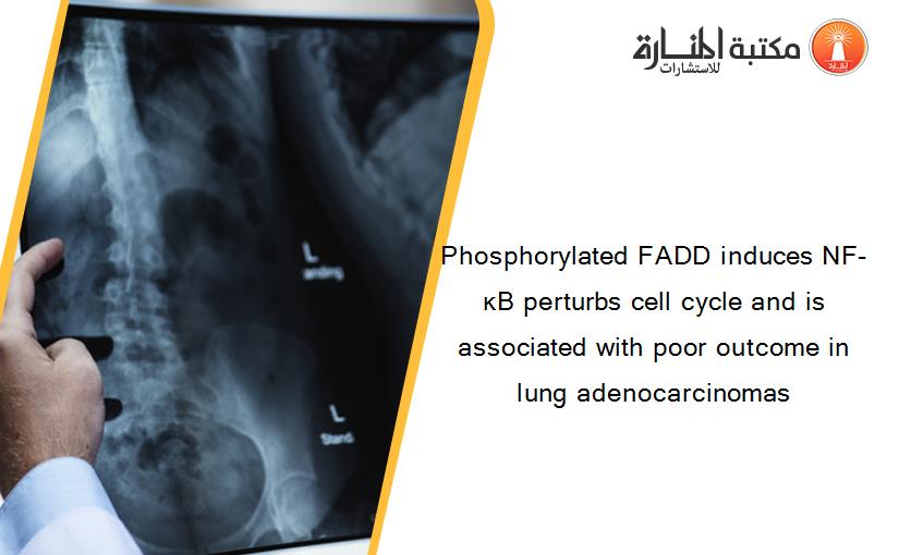 Phosphorylated FADD induces NF-κB perturbs cell cycle and is associated with poor outcome in lung adenocarcinomas