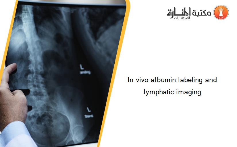 In vivo albumin labeling and lymphatic imaging