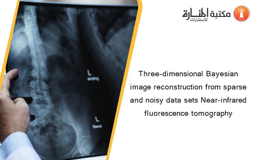 Three-dimensional Bayesian image reconstruction from sparse and noisy data sets Near-infrared fluorescence tomography