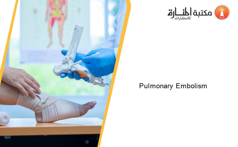 Pulmonary Embolism