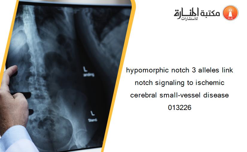 hypomorphic notch 3 alleles link notch signaling to ischemic cerebral small-vessel disease 013226