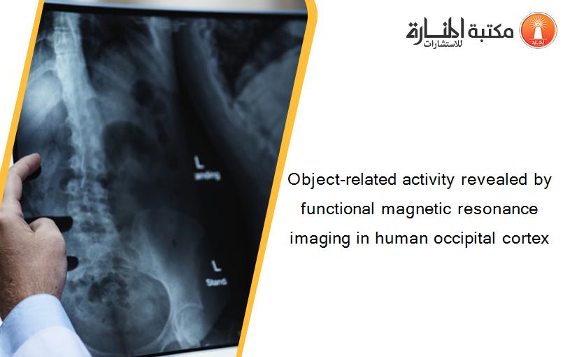 Object-related activity revealed by functional magnetic resonance imaging in human occipital cortex