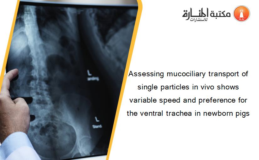 Assessing mucociliary transport of single particles in vivo shows variable speed and preference for the ventral trachea in newborn pigs