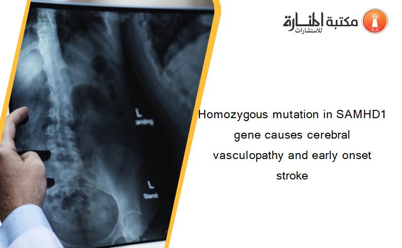 Homozygous mutation in SAMHD1 gene causes cerebral vasculopathy and early onset stroke