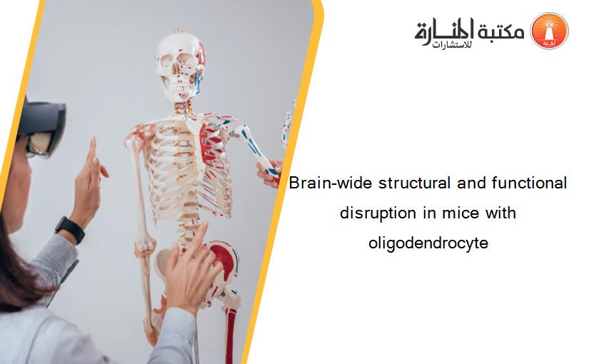 Brain-wide structural and functional disruption in mice with oligodendrocyte