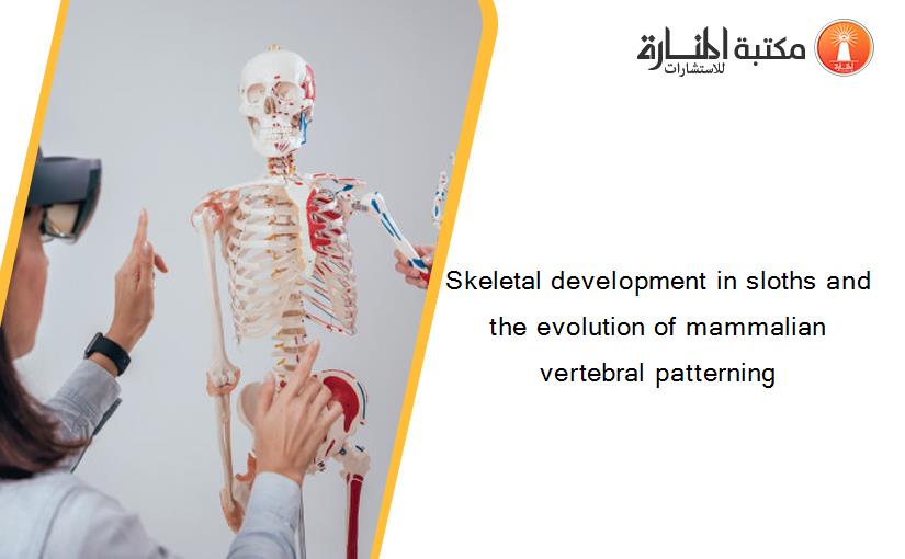 Skeletal development in sloths and the evolution of mammalian vertebral patterning