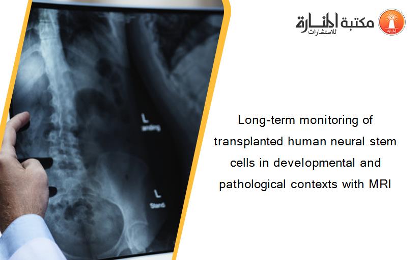 Long-term monitoring of transplanted human neural stem cells in developmental and pathological contexts with MRI