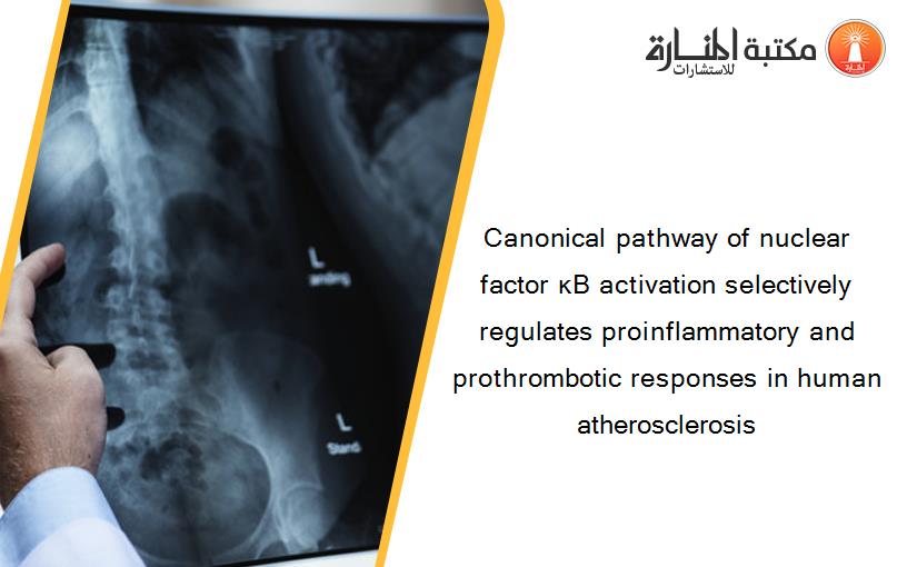 Canonical pathway of nuclear factor κB activation selectively regulates proinflammatory and prothrombotic responses in human atherosclerosis