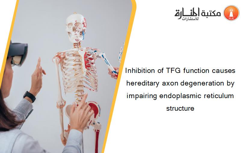 Inhibition of TFG function causes hereditary axon degeneration by impairing endoplasmic reticulum structure