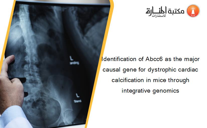 Identification of Abcc6 as the major causal gene for dystrophic cardiac calcification in mice through integrative genomics