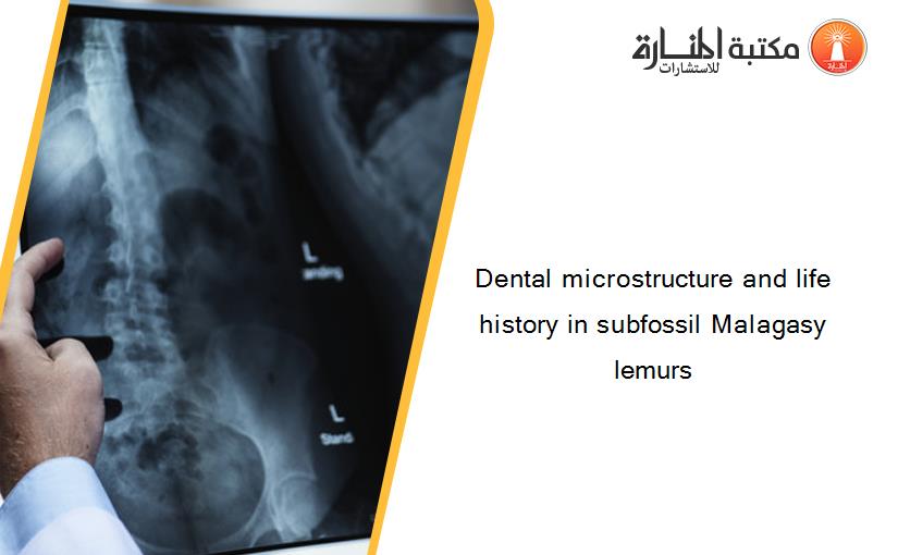 Dental microstructure and life history in subfossil Malagasy lemurs